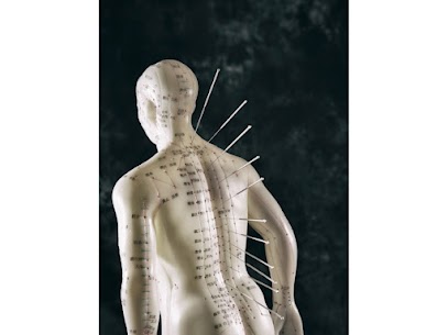 DOES ACUPUNCTURE WORK FOR MIGRAINES?   Acupuncture is very effective in treating migraines because it stimulates nerves and pressure points in the body, which relieves symptoms.  Acupuncture can help with:  Neck tightness is reduced by inserting needles into trigger points where muscles are constricted.  Stimulate endorphin release, which alleviates pain and creates feelings of well-being.  Promote healthy blood circulation by reducing inflammation and modulating brain chemicals that control blood vessel constriction and dilation. Migraine symptoms are relieved when blood vessels constrict (narrow).  Lower stress and promote relaxation by regulating hormone levels. Hormones such as cortisol, serotonin, noradrenaline, and dopamine play a role in how the body responds to stress; when these hormones are balanced, your body adapts to stress more efficiently. The onset of migraines has been linked to an imbalance in serotonin levels in the brain.  Boost immune function, which helps regulate inflammation and the production of prostaglandins (pain-promoting hormones).    GET IN TOUCH Acupuncture has been shown to be effective in treating migraine symptoms and restoring body balance by reducing pain, inflammation, and neck muscle tightness. It also aids in the promotion of relaxation and the regulation of serotonin levels in the brain. Speak to our experienced acupuncturists at Komp Chiropractic and Acupuncture Clinic today if you want to manage your migraines naturally.