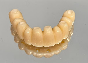 Photo n°6 de Armadent - laboratoire de prothèses dentaires à La Chapelle-sur-Erdre (Chirurgien orthopédiste)