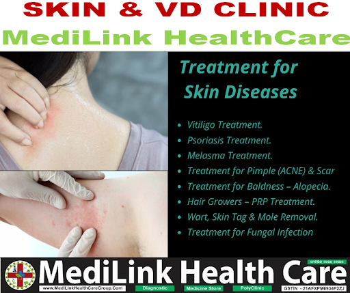 MediLinkHealthCare ହସ୍ପିଟାଲରେ ଆମେ କେଶ ଏବଂ ନଖ ସମେତ ସମସ୍ତ ପ୍ରକାର ଚର୍ମ ସମ୍ବନ୍ଧୀୟ ସମସ୍ୟା ପାଇଁ ଆପଣଙ୍କୁ… post image