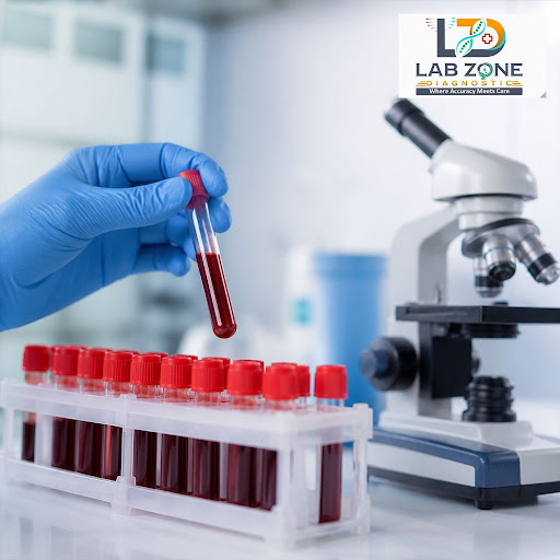 Early detection can make all the difference in the fight against cancer. At Lab Zone Diagnostic i… post image