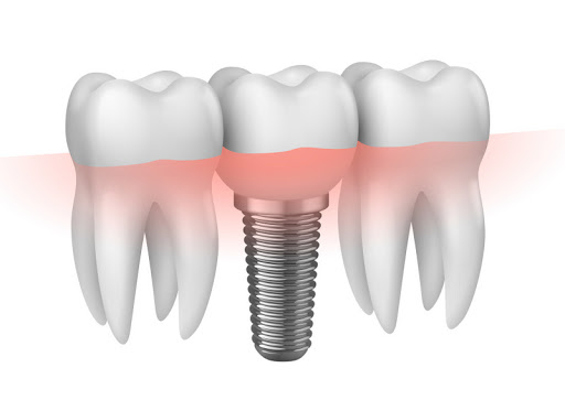 Studio Dentistico Tomat dott. Fausto - Thumbnail