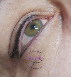 Photo n°16 de Dermo Expert à Marseillan (Institut de beauté)