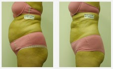 Palma Skin Clinic luton