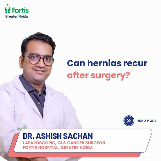 Yes, hernias can indeed recur after surgery. While hernia repair surgeries are generally effectiv… post image
