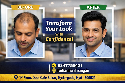 Farhan Hair Fixing specializes in advanced non-surgical hair replacement solutions that deliver a… post image