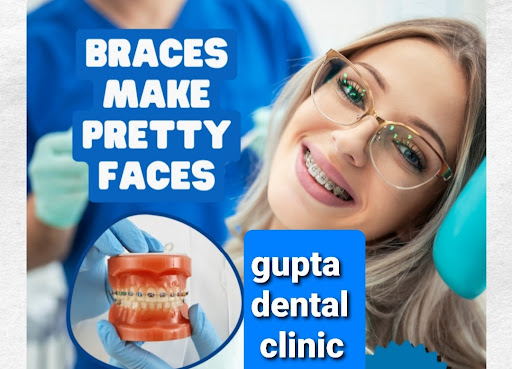 Orthodontic treatment (braces) post image
