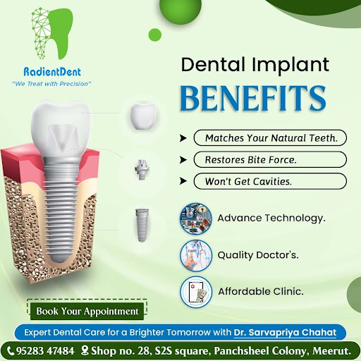 Being the best dental implant in Meerut, Radient Dent is expertly known to provide great dental c… post image