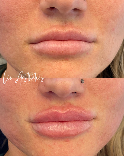 Liv Aesthetics & Wellness - Botox, med spa, Integrative medicine