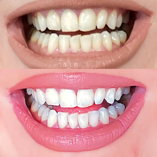 Zahnarzt Kais Zainab | All You Need Dental MVZ für Oralchirurgie und Zahnmedizin GmbH - Thumbnail