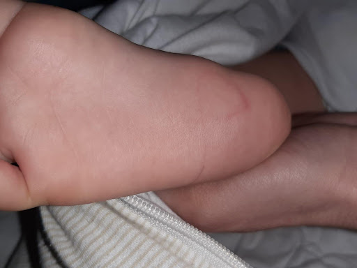 Tameside Foot Clinic - Thumbnail