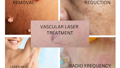 Smooth and Remove - Visual
