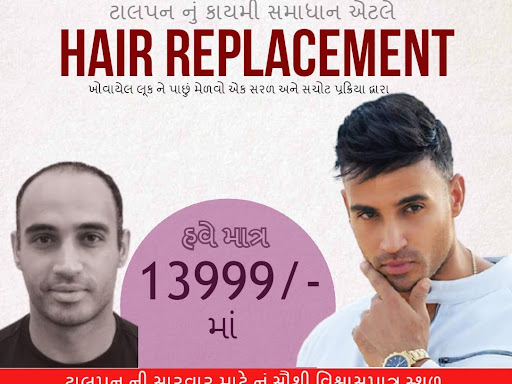 Get you Hair Replacement Treatment done @ 13999/- post image