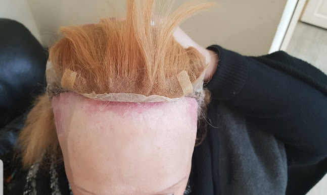 http://www.elite9hairclinic.co.uk/