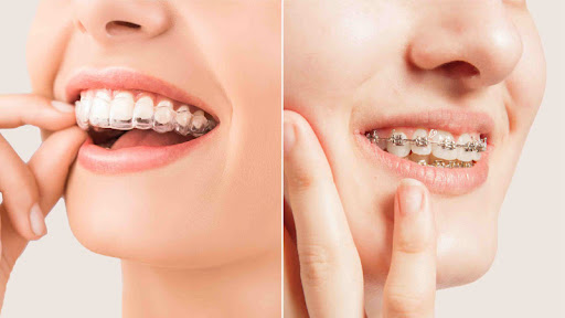 Orthodontic month- starting 20000 onwards post image