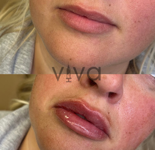 Viva Skin Lounge