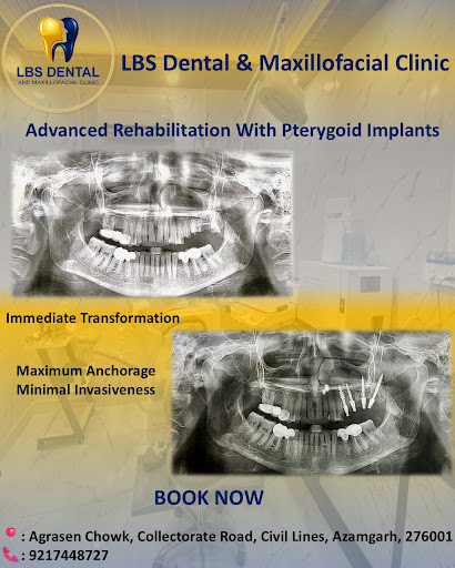 At LBS Dental & Maxillofacial Clinic, we provide cutting-edge solutions for patients with severe… post image