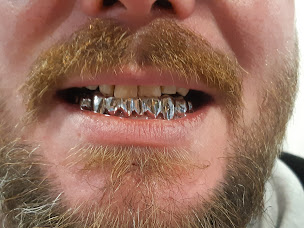 Photo n°3 de Laboratoire Fraysse Dental Création (LFDC) à Limoges (Centre de prothèses dentaires)