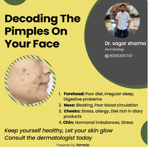 Decoding the pimples on your face