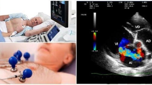 Cardiologo en Valle de Santiago | Dr. Rolando Talavera Otero - Thumbnail