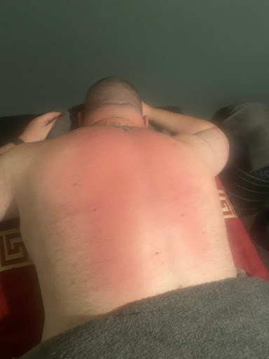 RW Sports Rehabilitation Wirral - Thumbnail