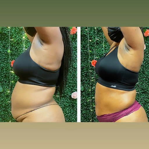 Shaped By So Chic Body Spa & Esthetics - Thumbnail