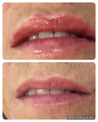 Aesthetics Beauty By nikki - Thumbnail