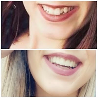 Diş hekimi Seydi Küçükdağılkan Diş Hekimi Murat Pircanoğlu