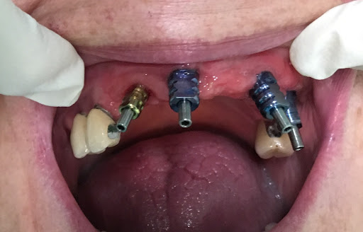 Studio Odontoiatrico Dott. Diano Demetrio Medico Chirurgo Odontoiatra - Thumbnail