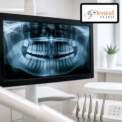 At My Dental Clinic - Dr. Neha Chintawar, we use advanced digital dental X-rays to detect problem… post image
