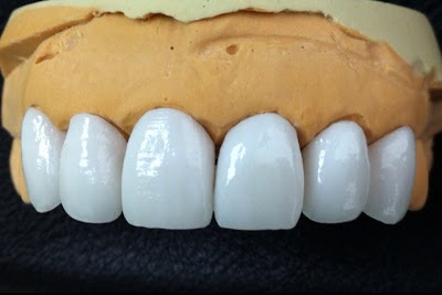 Photos of Dr. Hussein Labib Dental Clinic