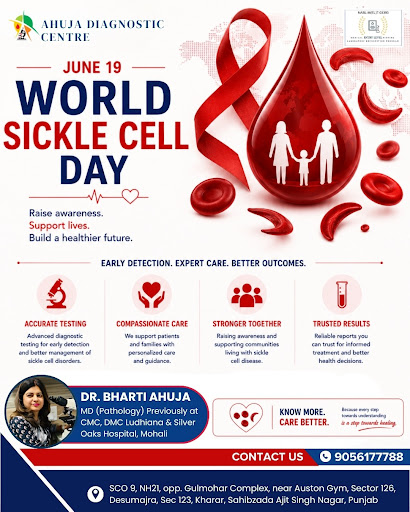 World Sickle Cell Day: Why Early Testing Matters post image