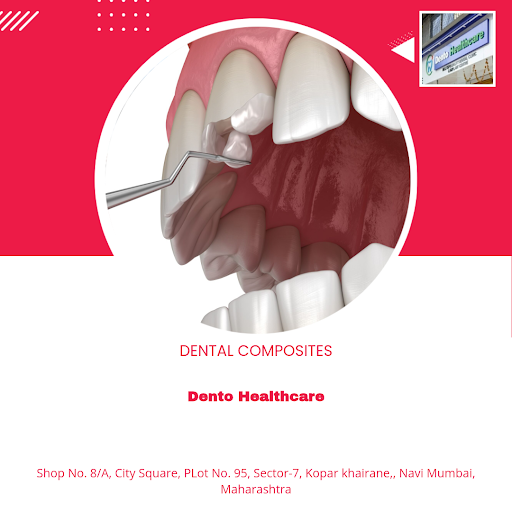 Transform your smile with our premium Dental Composites at Dento Healthcare in Navi Mumbai. Get t… post image