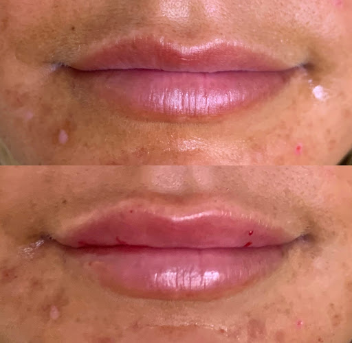 Beach Medical Aesthetics