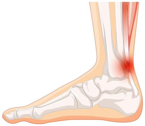 With years of experience and expertise in orthopaedic care, Dr. Varun Ahuja (PT) is dedicated to… post image