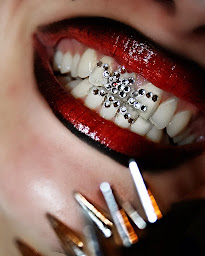 Photo n°10 de 69strass à Lyon (Dentiste cosmétique)