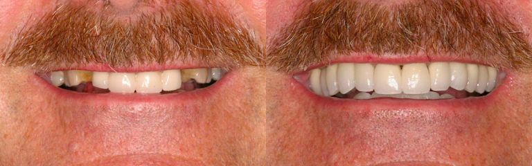 Sonoran Dental Design