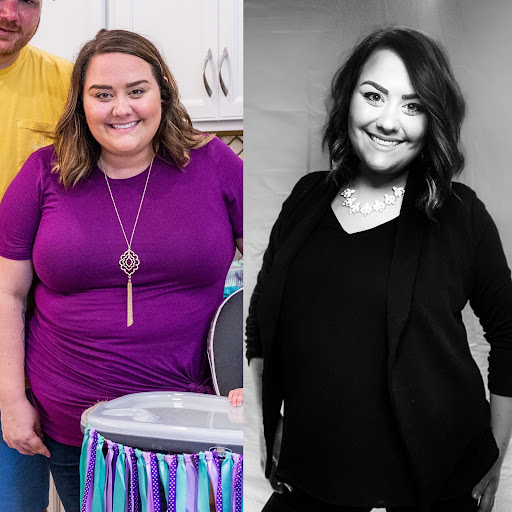 Advanced Skin & Weight Loss - Thumbnail