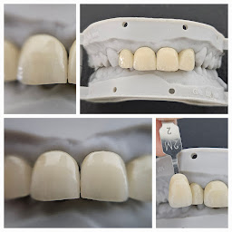 Photo n°8 de Laboratoire BRIET prothèsiste dentaire à Saint-Orens-de-Gameville (Centre de prothèses dentaires)