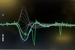 Photo n°5 de Docteur Catherine Vidal à Paris (Neurophysiologiste)