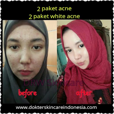 Photos of Konsultan Kecantikan DRW SKINCARE