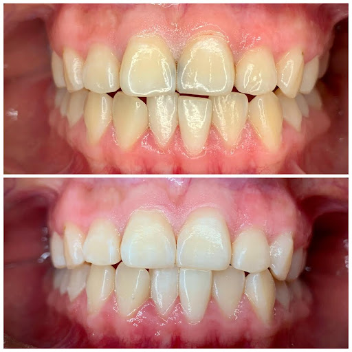 Cirujano dentista Jafet Jiménez (dentaliving) - Thumbnail