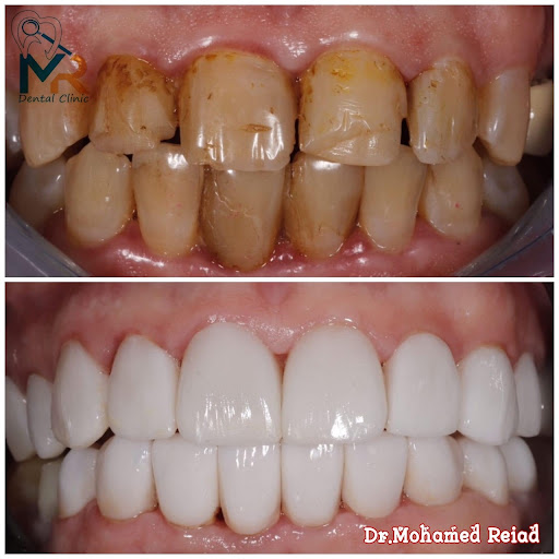 For U Dental clinic - صورة 2