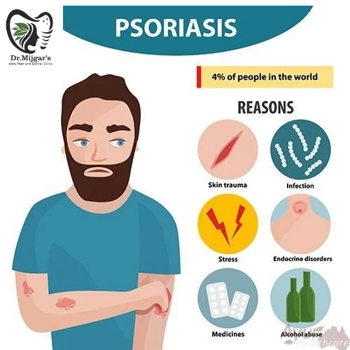 "Successful psoriasis treatment at Dr. Mijgar's Clinic – Visible results, safe Ayurvedic & dermat… post image
