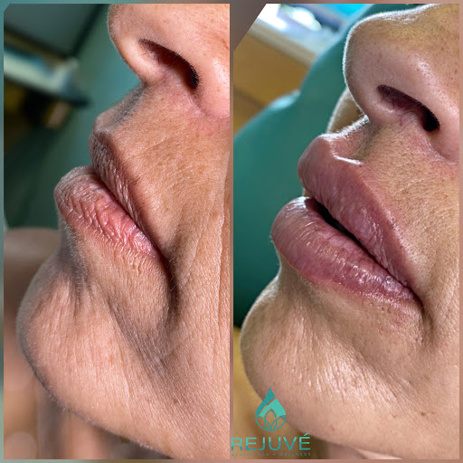 Rejuve Aesthetics & Wellness
