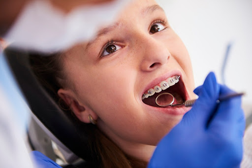 Children�s orthodontics focuses on diagnosing and treating dental irregularities such as crooked… post image