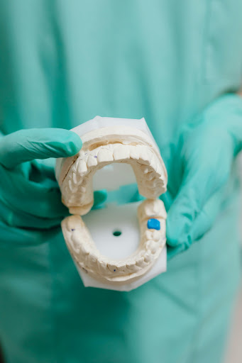 Dental Bridge Treatment