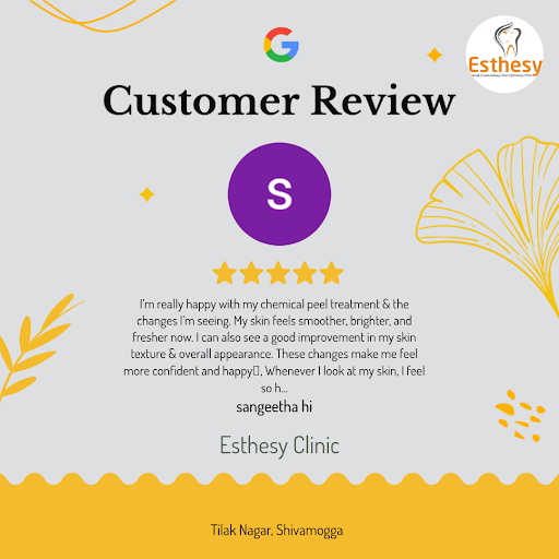 Sangeetha hi! I'm thrilled to share my exceptional experience at Esthesy Clinic, Shivamogga's pre… post image