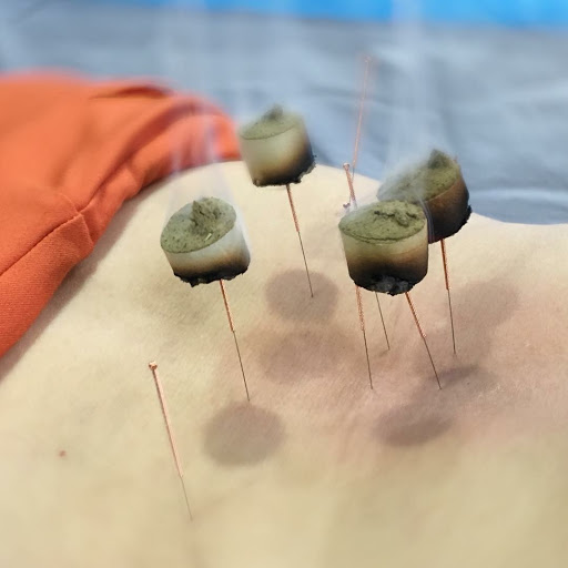 Herbs & Acupuncture Healthcare - Thumbnail