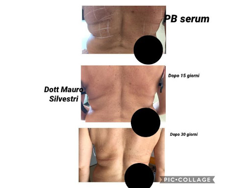 Mauro dott. silvestri medicina estetica - Thumbnail