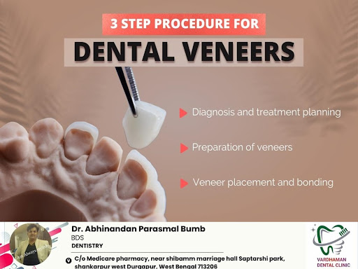 The dental veneer procedure involves three key steps. Firstly diagnosis and treatment planning ar… post image